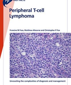 Fast Facts: Peripheral T-cell Lymphoma: Unraveling the complexities of diagnosis and management (PDF)