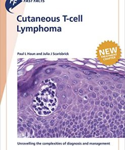 Fast Facts: Cutaneous T-cell Lymphoma (PDF)