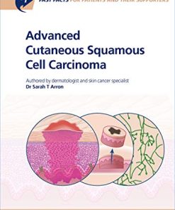 Fast Facts: Advanced Cutaneous Squamous Cell Carcinoma for Patients and their Supporters: Information + Taking Control = Best Outcome (PDF)