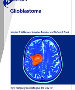 Fast Facts: Glioblastoma: New molecular concepts pave the way for advances in diagnosis and treatment (PDF)