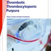 Fast Facts: Thrombotic Thrombocytopenic Purpura: Prompt action saves lives (PDF)
