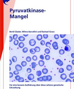 Fast Facts: Pyruvatkinase-Mangel (German Edition) (PDF)