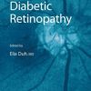 Diabetic Retinopathy (EPUB)