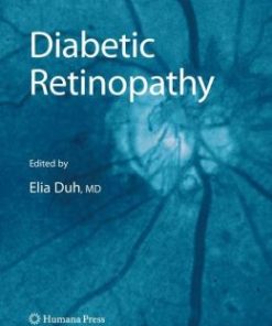 Diabetic Retinopathy (EPUB)