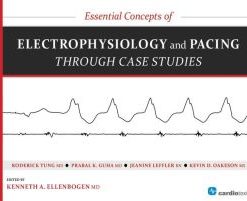 Essential Concepts of Electrophysiology and Pacing through Case Studies (PDF)