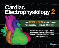 Cardiac Electrophysiology 2: An Advanced Visual Guide for Nurses, Techs, and Fellows (PDF)