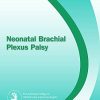 Neonatal Brachial Plexus Palsy (EPUB)