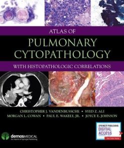 Atlas of Pulmonary Cytopathology (EPUB)