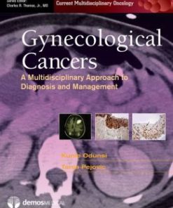 Gynecologic Cancers: A Multidisciplinary Approach to Diagnosis and Management