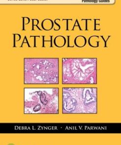 Prostate Pathology