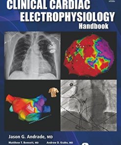 The Clinical Cardiac Electrophysiology Handbook