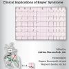 Interatrial Block and Supraventricular Arrhythmias: Clinical Implications of Bayes’ Syndrome (PDF)