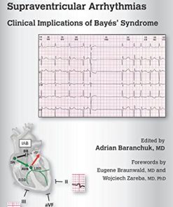 Interatrial Block and Supraventricular Arrhythmias: Clinical Implications of Bayes’ Syndrome (PDF)