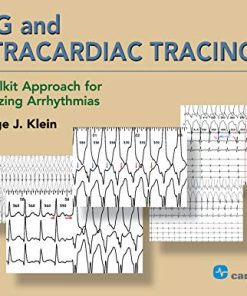 ECG and Intracardiac Tracings: A Toolkit Approach for Analyzing Arrhythmias (HQ PDF)