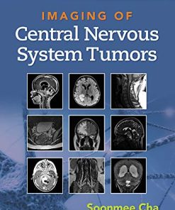 Imaging of Central Nervous System Tumors (ePub3+Converted PDF)