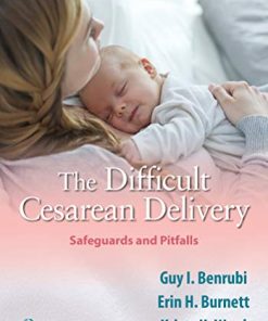 The Difficult Cesarean Delivery: Safeguards and Pitfalls (EPUB)