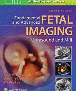 Fundamental and Advanced Fetal Imaging Ultrasound and MRI, 2ed (EPUB)