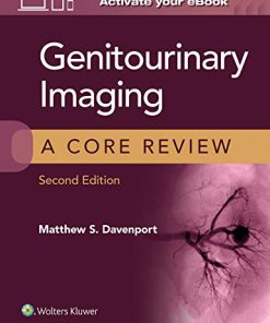 Genitourinary Imaging: A Core Review, 2ed (ePub+azw3+Converted PDF)