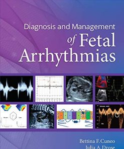 Diagnosis and Management of Fetal Arrhythmias (EPUB)