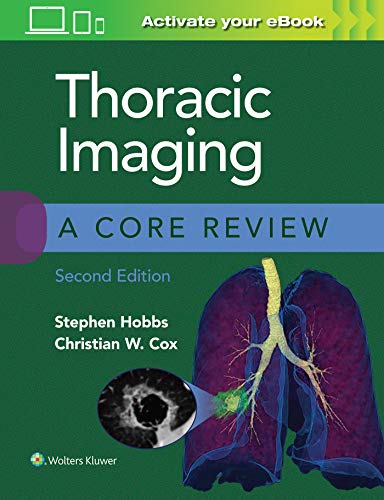 Thoracic Imaging: A Core Review, 2nd edition (ePub+Converted PDF) Thoracic Imaging: A Core Review, 2nd edition (ePub+Converted PDF)