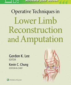 Operative Techniques in Lower Limb Reconstruction and Amputation (EPUB + Converted PDF)