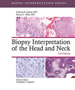 Biopsy Interpretation of the Head and Neck (Biopsy Interpretation Series), 3rd Edition (EPUB)