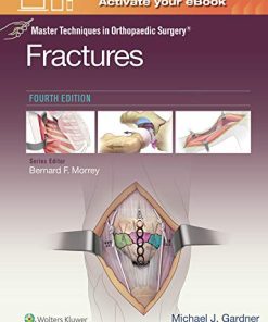 Master Techniques in Orthopaedic Surgery: Fractures, 4ed (ePub+Converted PDF)