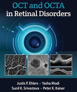 OCT and OCT Angiography in Retinal Disorders (EPUB)