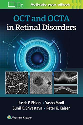 OCT and OCT Angiography in Retinal Disorders (EPUB) OCT and OCT Angiography in Retinal Disorders (EPUB)