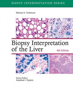 Biopsy Interpretation of the Liver (Biopsy Interpretation Series), 4th Edition (EPUB3 + Converted PDF)