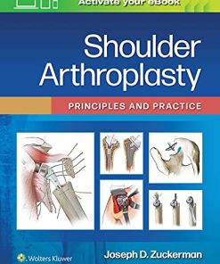 Shoulder Arthroplasty: Principles and Practice (ePub3+Converted PDF)