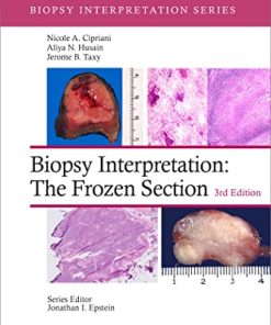 Biopsy Interpretation: The Frozen Section, 3rd Edition (Biopsy Interpretation Series) (EPUB)