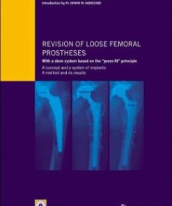 Revision of loose femoral prostheses with a stem system based on the ”press-fit” principle: A concept and its system of implants, a method and its results (PDF)