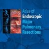 Atlas of endoscopic major pulmonary resections (PDF)