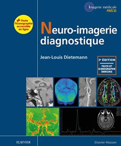 Neuro-imagerie diagnostique, 3e (PDF)