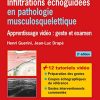 Infiltrations échoguidées en pathologie musculosquelettique: Apprentissage vidéo : geste et examen (Imagerie médicale : pratique) (French Edition) (PDF)