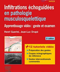 Infiltrations échoguidées en pathologie musculosquelettique: Apprentissage vidéo : geste et examen (Imagerie médicale : pratique) (French Edition) (PDF)