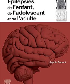 Epilepsies de l’enfant, de l’adolescent et de l’adulte: De la physiopathologie à la prise en charge (Neurologie) (French Edition) (PDF)