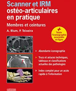 Scanner et IRM ostéo-articulaires en pratique: Membres et ceintures (PDF)