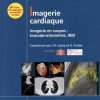 Imagerie cardiaque: Imagerie en coupes : scanner, IRM (Imagerie médicale : Précis) (French Edition) (True PDF Publisher Quality)