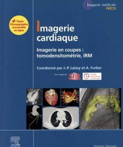 Imagerie cardiaque: Imagerie en coupes : scanner, IRM (Imagerie médicale : Précis) (French Edition) (True PDF Publisher Quality)