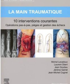 La main traumatique 10 interventions courantes: Manuel de chirurgie du membre supérieur (Hors collection) (French Edition) (True PDF+Videos)