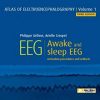 Atlas of Electroencephalography. Awake and sleep EEG. Activation procedures and artifacts Vol 1 (PDF)