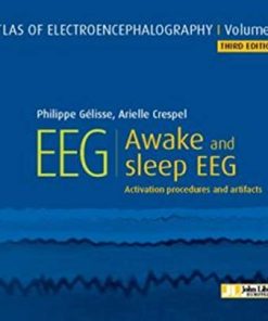 Atlas of Electroencephalography. Awake and sleep EEG. Activation procedures and artifacts Vol 1 (PDF)