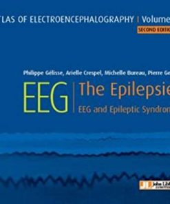 Atlas of electroencephalography:The Epilepsies. EEG and epileptic syndromes Vol 2 (ePub+Converted PDF)