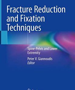 Fracture Reduction and Fixation Techniques: Spine-Pelvis and Lower Extremity (PDF)