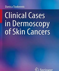 Clinical Cases in Dermoscopy of Skin Cancers (Clinical Cases in Dermatology) (PDF)