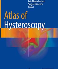 Atlas of Hysteroscopy (PDF)