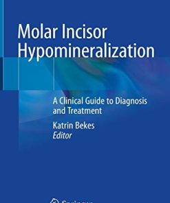 Molar Incisor Hypomineralization: A Clinical Guide to Diagnosis and Treatment (PDF)