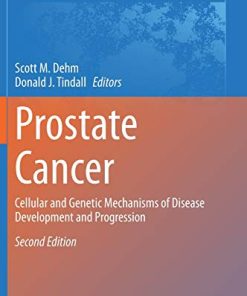 Prostate Cancer: Cellular and Genetic Mechanisms of Disease Development and Progression (Advances in Experimental Medicine and Biology) (PDF)